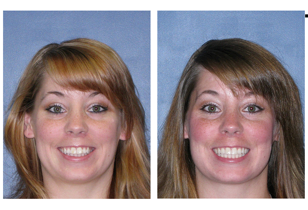 Dental Smiles of Bolingbrook