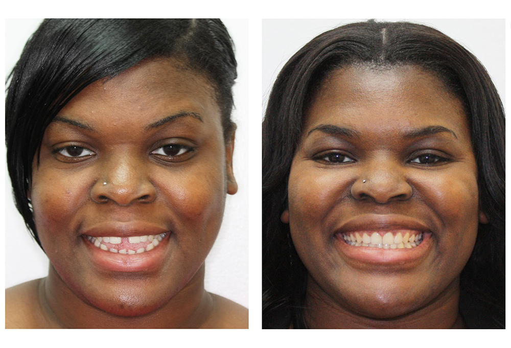 Dental Smiles of Bolingbrook