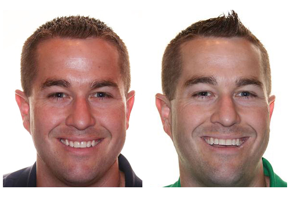 Dental Smiles of Bolingbrook