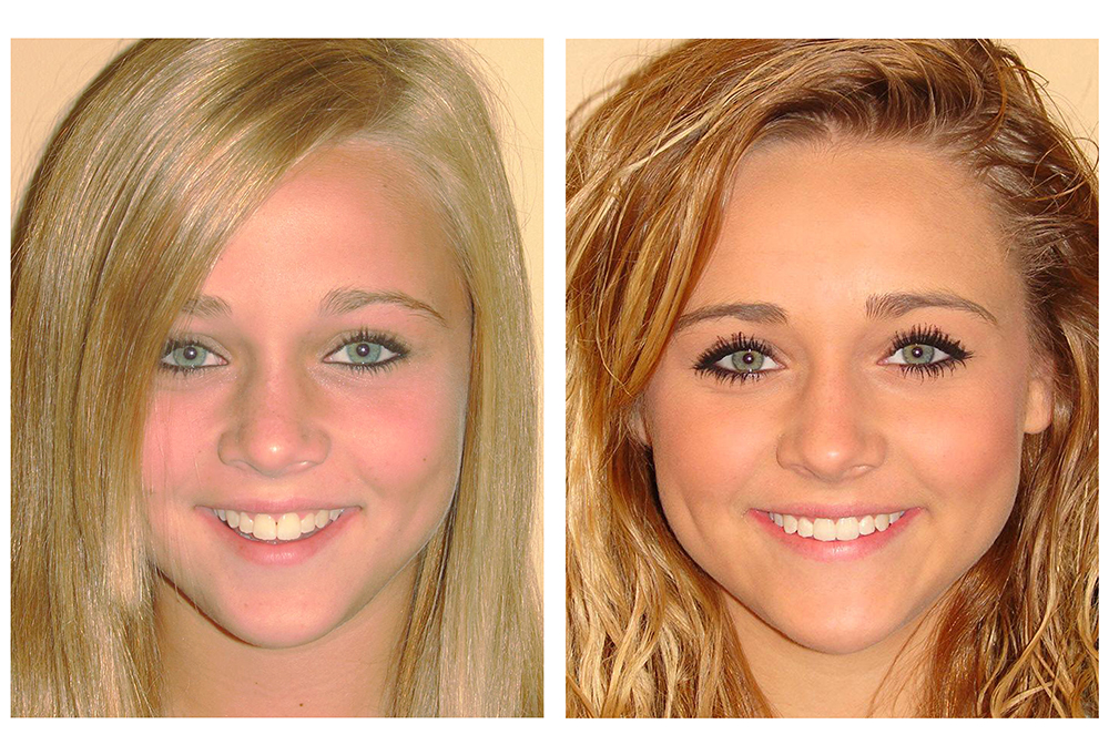 Dental Smiles of Bolingbrook