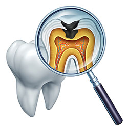 An illustration of a magnified dental tooth with an internal view, highlighting the pulp chamber and root canal system, accompanied by a magnifying glass.