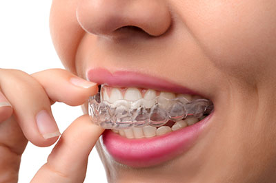 A person with a smile, holding and inspecting their clear orthodontic aligners.