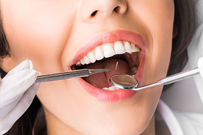 A woman with a smiling expression undergoing dental treatment, holding a toothbrush and with a dental mirror in her mouth.