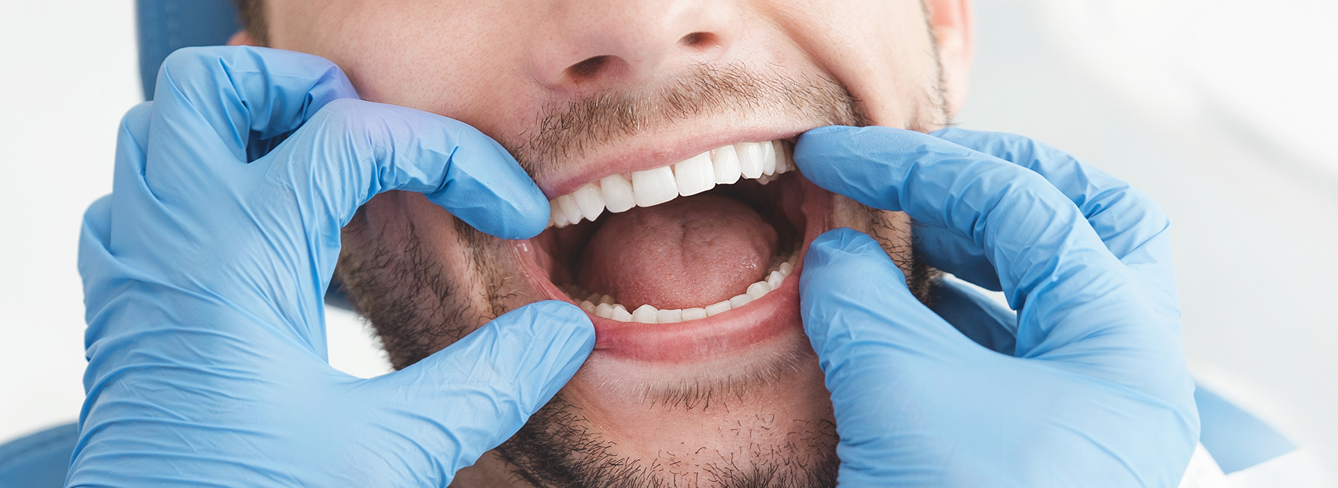 The image features a smiling man in a dental office environment, wearing a blue surgical gown and holding his mouth open with his hands.