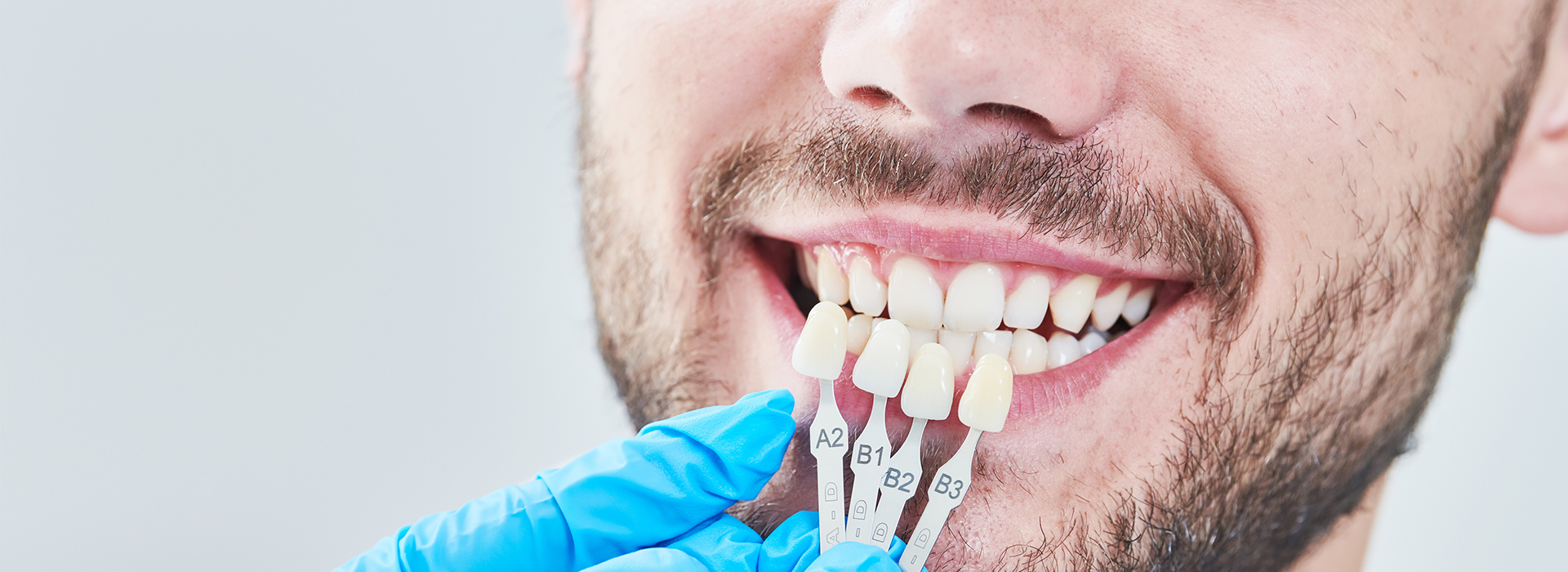 The image shows a man with a toothy smile, wearing a blue surgical mask and holding dental implants in his hand.