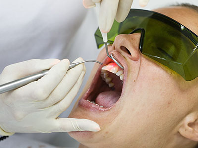 A person receiving dental care with a dentist using a drill, visible through protective eyewear.